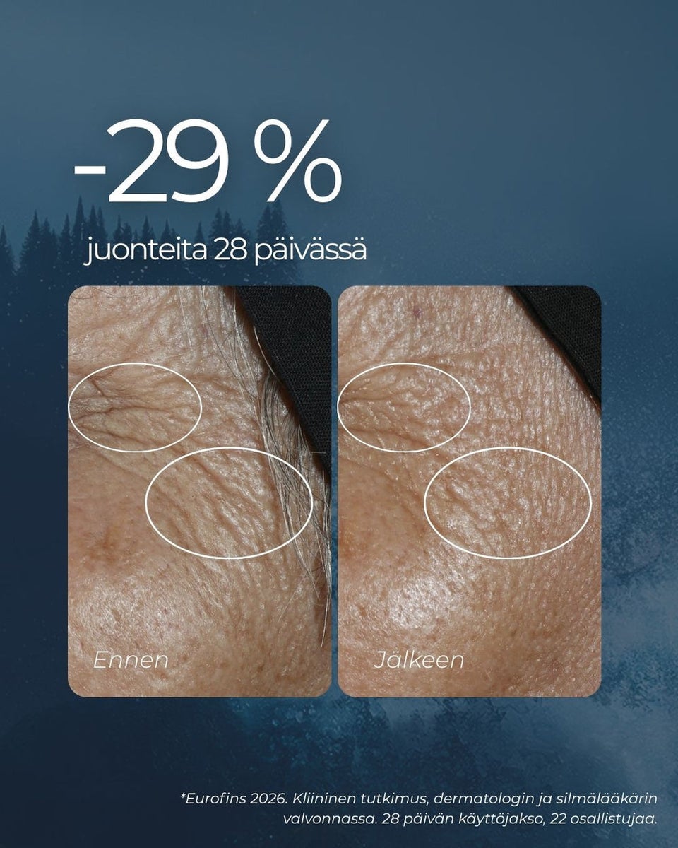 Saaren Taika rakkohauru silmänympärysvoide