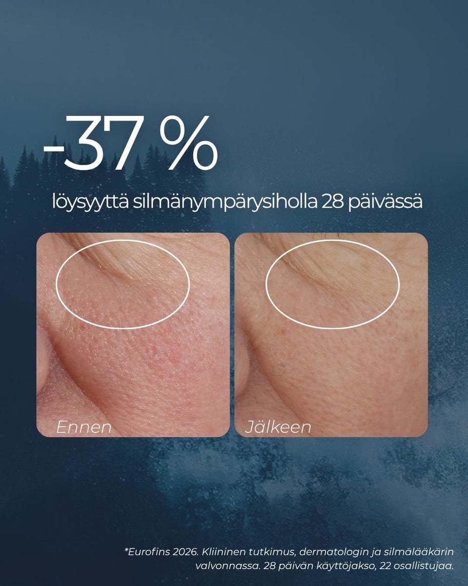 Saaren Taika rakkohauru silmänympärysvoide